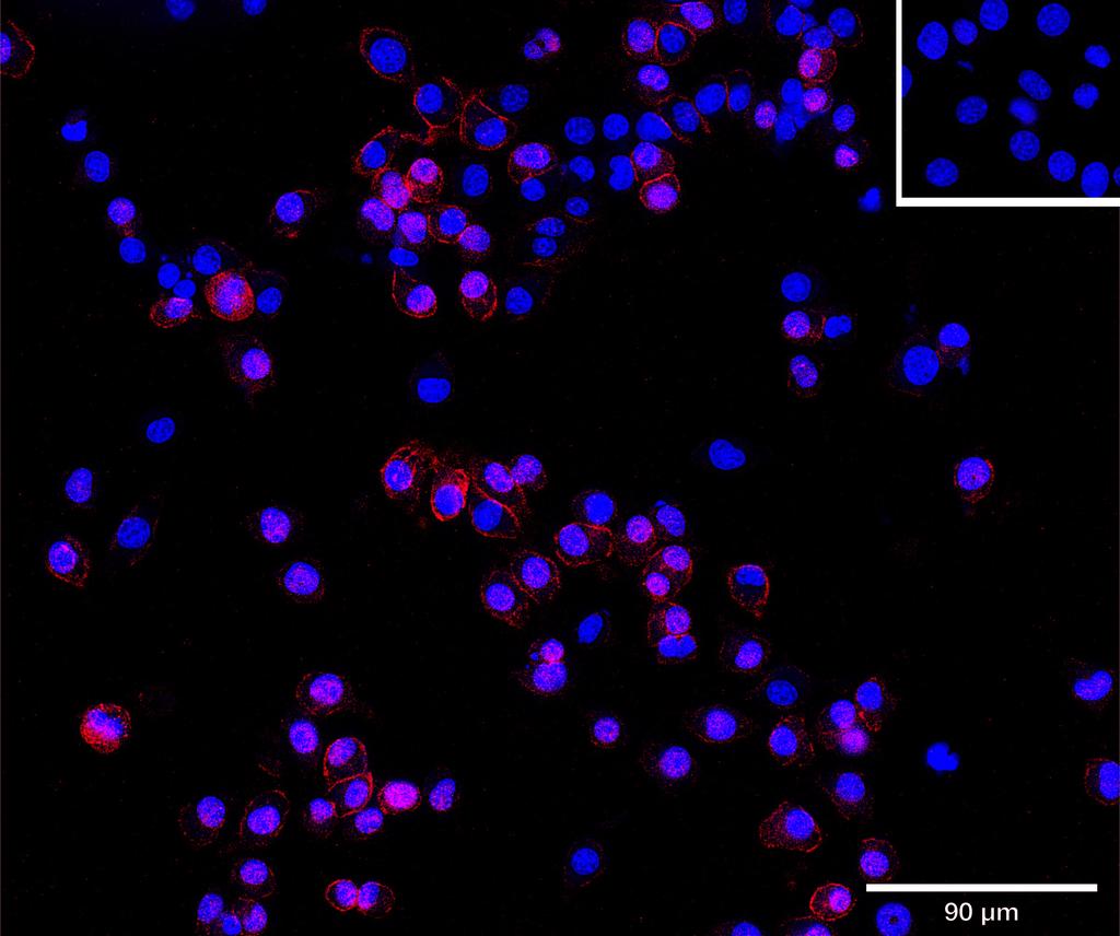 Ankyron CADM1_MOUSE Clone AT40741