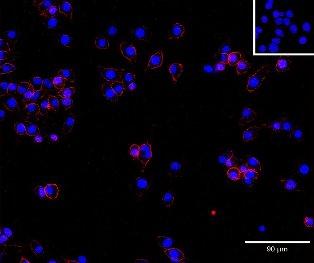 Ankyron CADM1_MOUSE Clone AT40742
