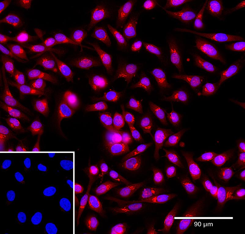Ankyron CAH4_HUMAN Clone CU30408