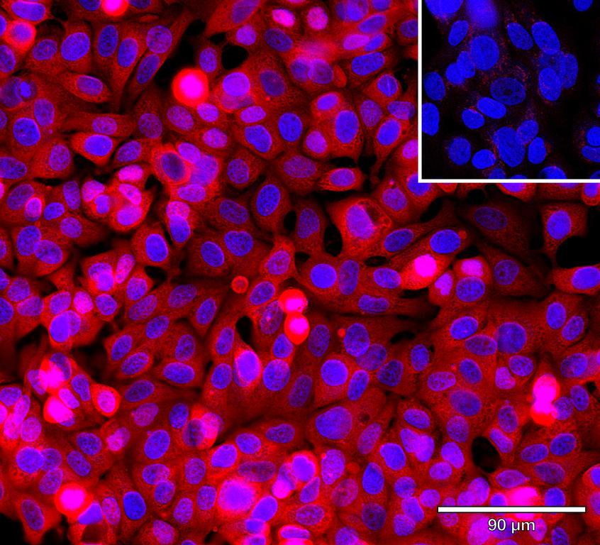 Ankyron CATB_HUMAN Clone CD30541
