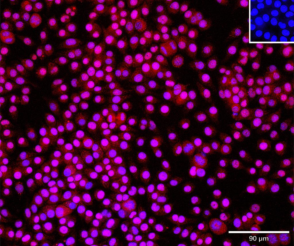 Ankyron CATB_MOUSE Clone BS40237