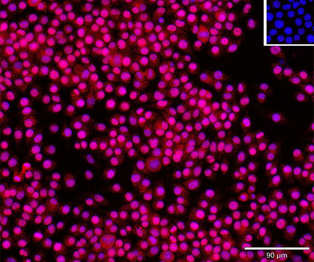 Ankyron CATB_MOUSE Clone BS40231