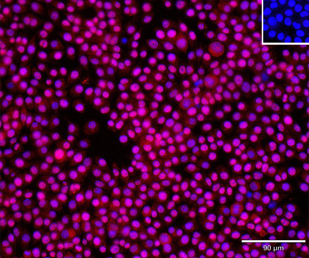Ankyron CATB_MOUSE Clone BS40234