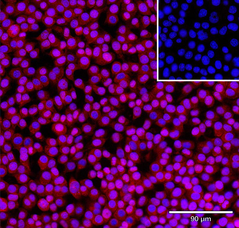 Ankyron CATD_MOUSE Clone CW40581