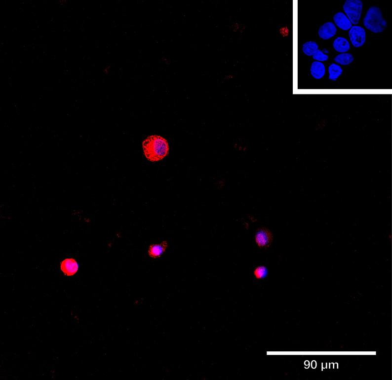 Ankyron CAVN1_HUMAN Clone EI40127