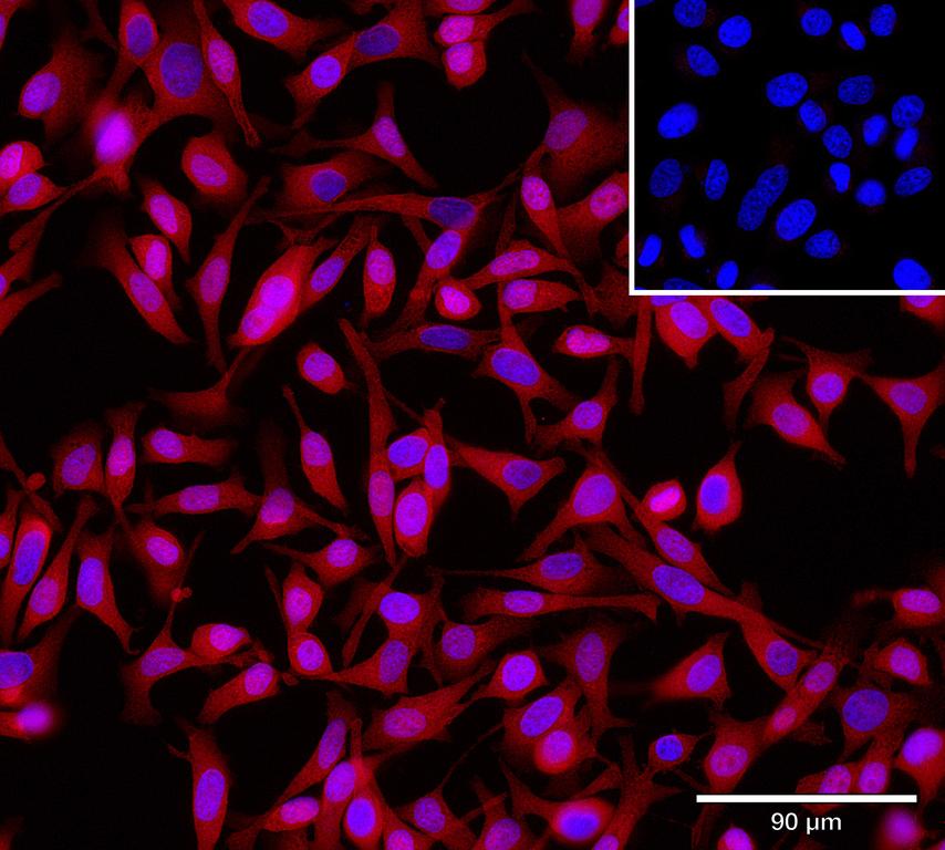 Ankyron CBPB1_HUMAN Clone CX40896