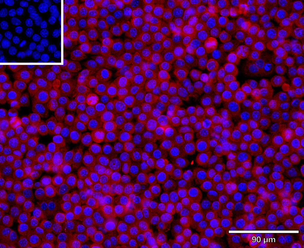 Ankyron CBPB2_MOUSE Clone AU40687