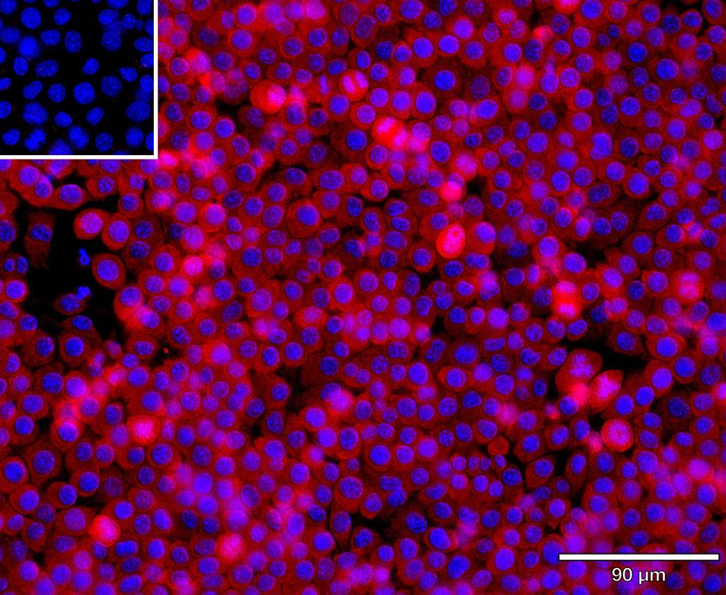 Ankyron CBPB2_MOUSE Clone AU40688