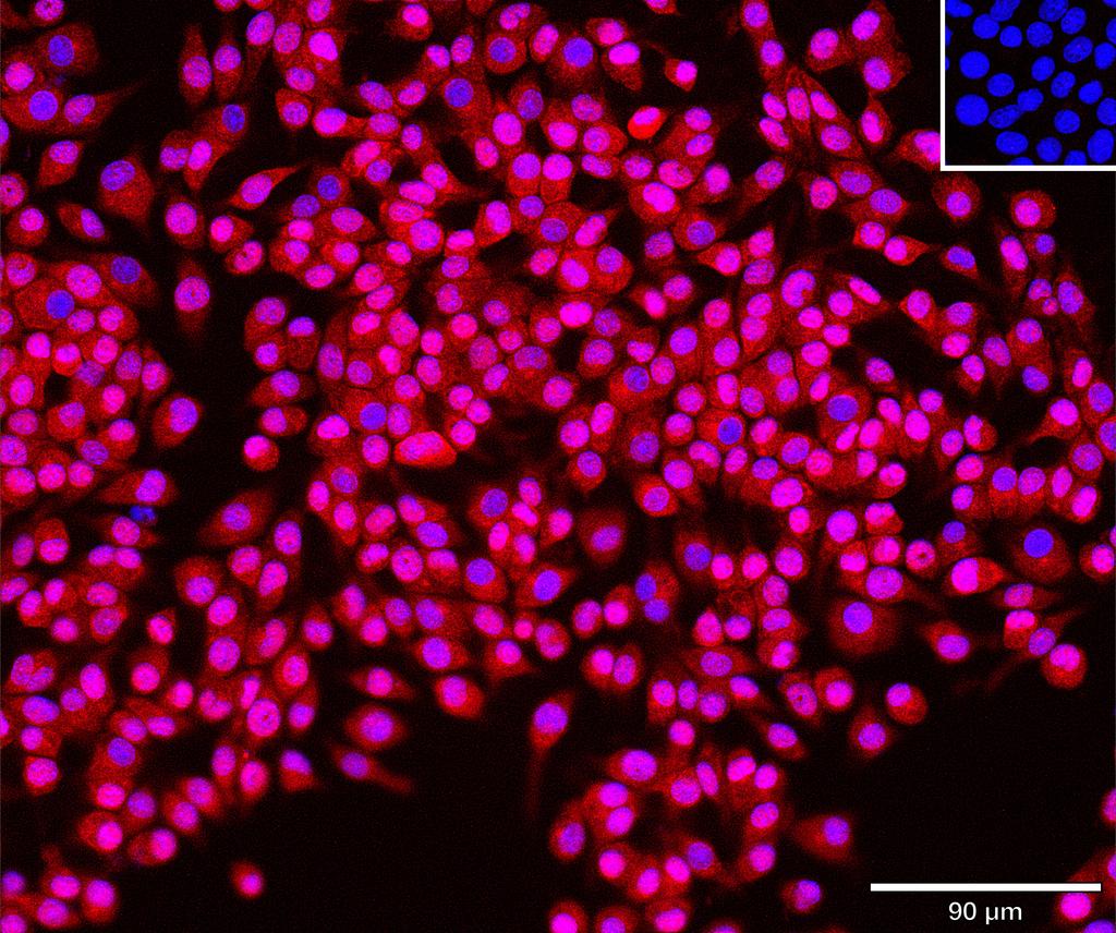 Ankyron CBPM_MOUSE Clone AU40861
