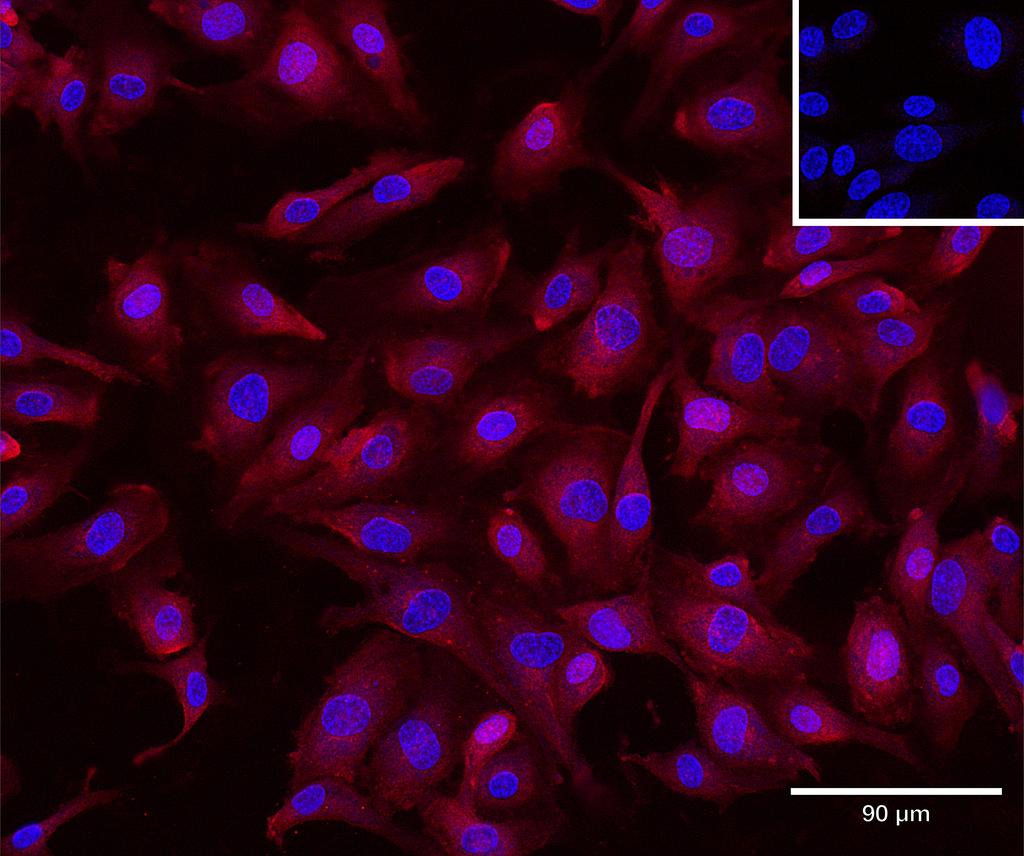 Ankyron CCD47_HUMAN Clone CS30170