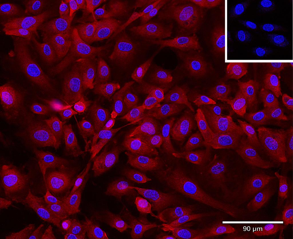 Ankyron CCD47_HUMAN Clone CS30171