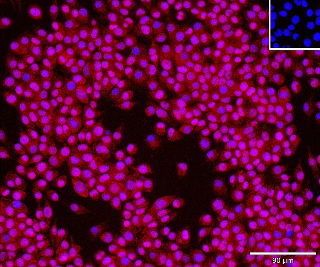 Ankyron CCD47_MOUSE Clone DC41027