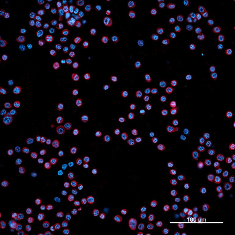 Ankyron CCL11_HUMAN Clone CT30675