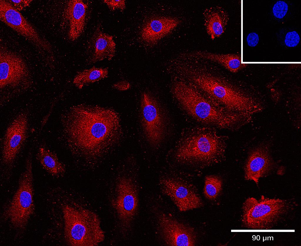 Ankyron CCL2_HUMAN Clone AB30107