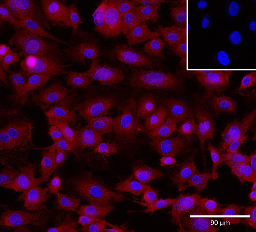 Ankyron CCL2_HUMAN Clone AB40146