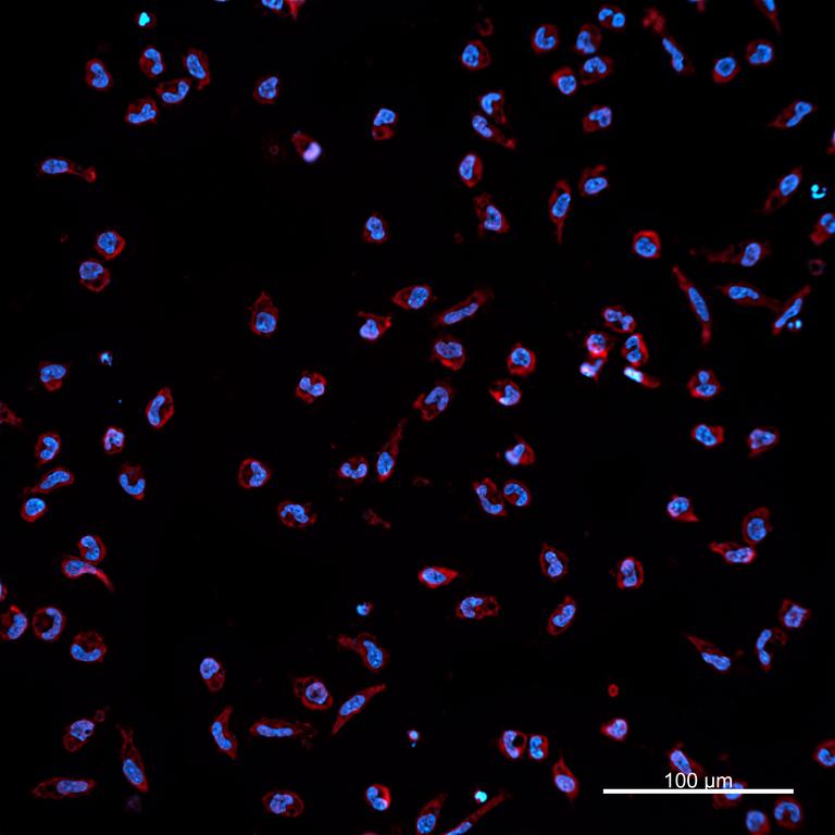 Ankyron CCL3_HUMAN Clone DS40474