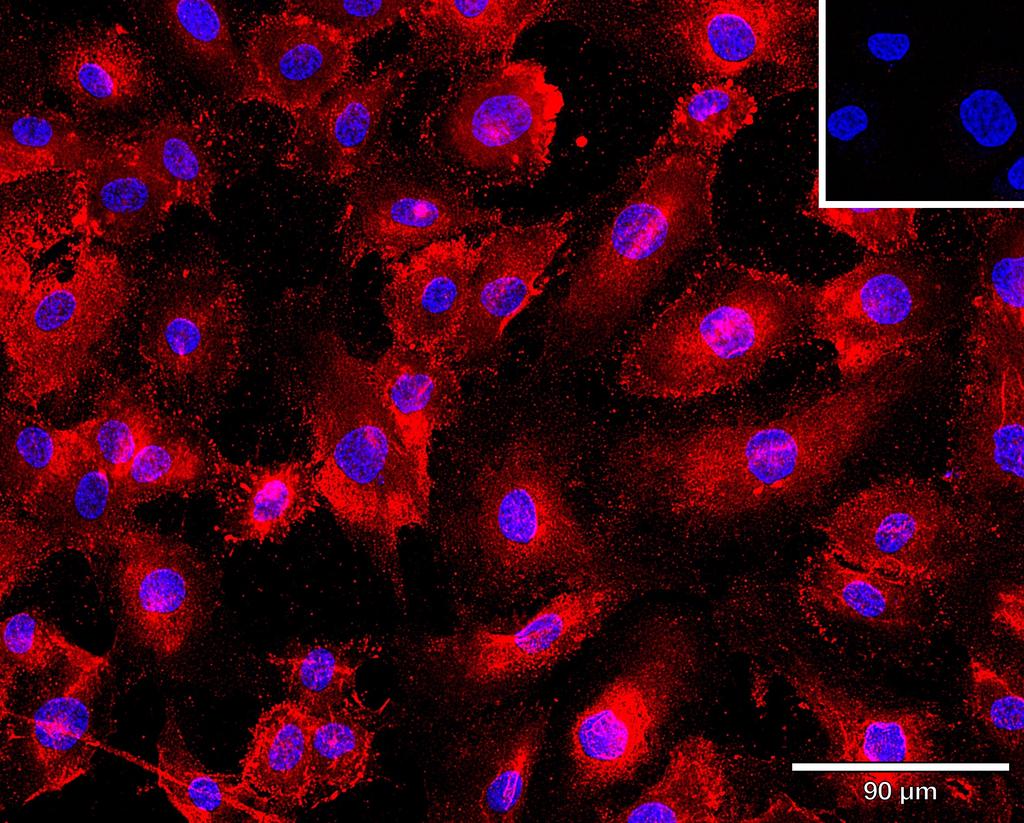 Ankyron CCL5_HUMAN Clone AB40165