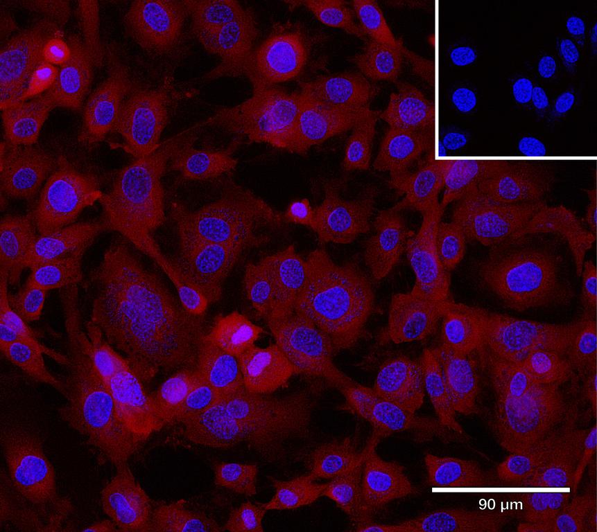 Ankyron CCL5_HUMAN Clone AB40167