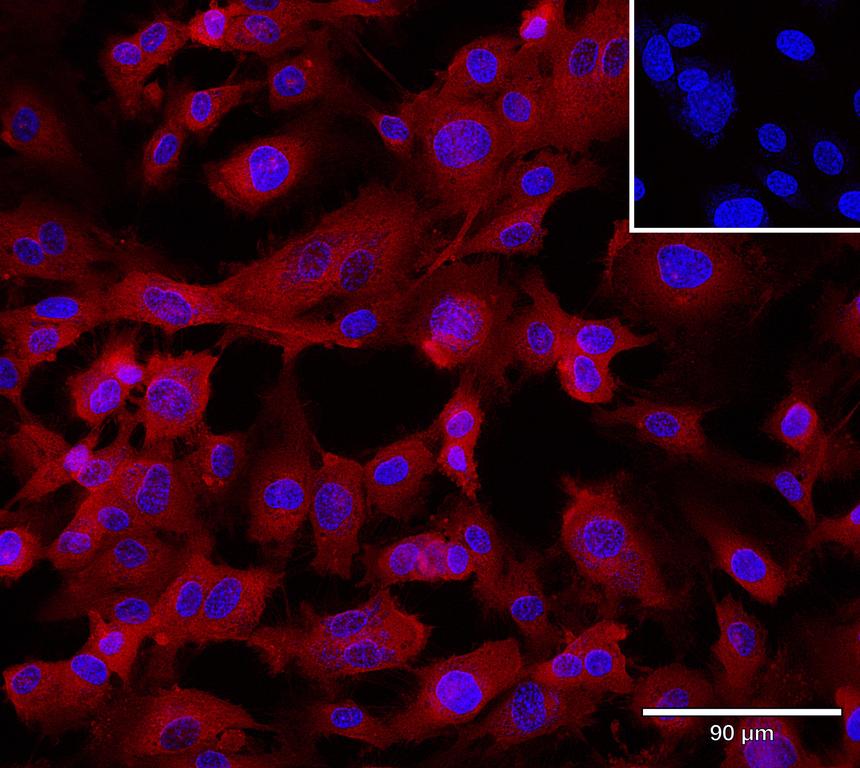 Ankyron CCL5_HUMAN Clone AB40178
