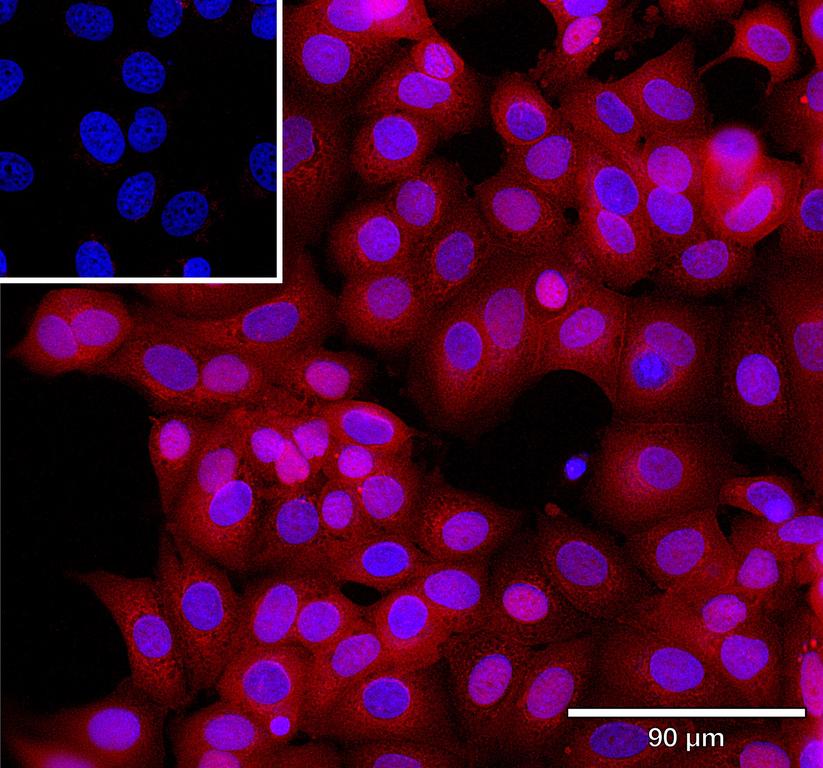 Ankyron CCN1_HUMAN Clone CO40471