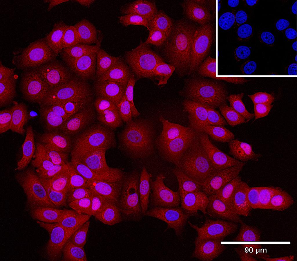 Ankyron CCN1_HUMAN Clone CO40489