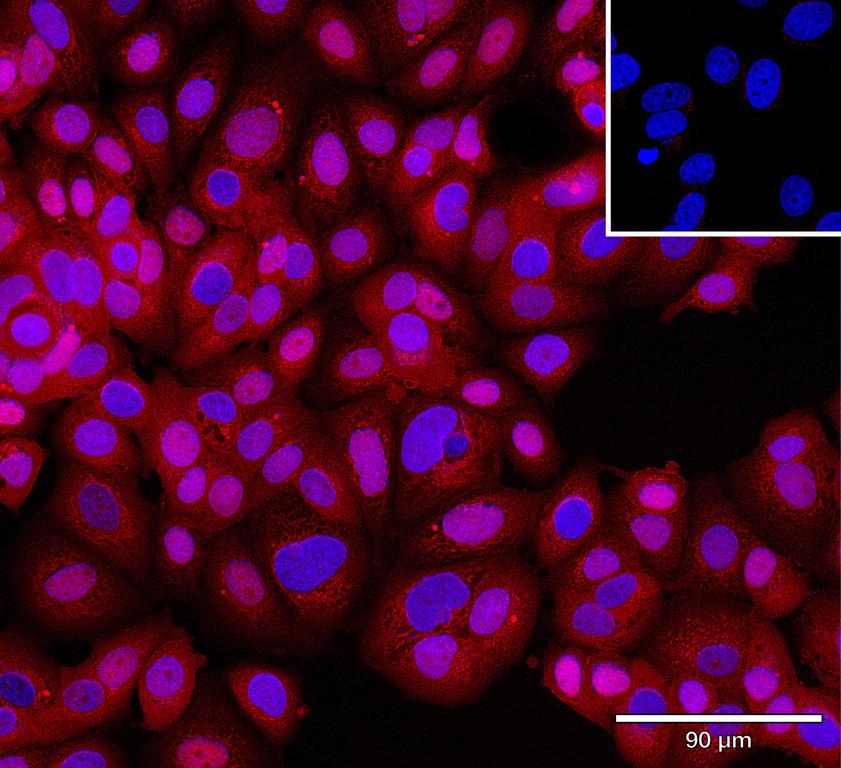 Ankyron CCN1_HUMAN Clone CO40492