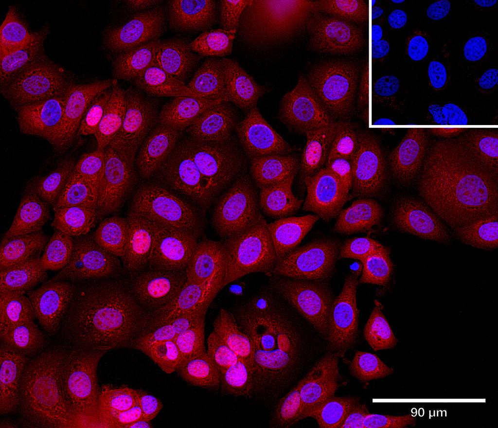 Ankyron CCN1_HUMAN Clone CO40473