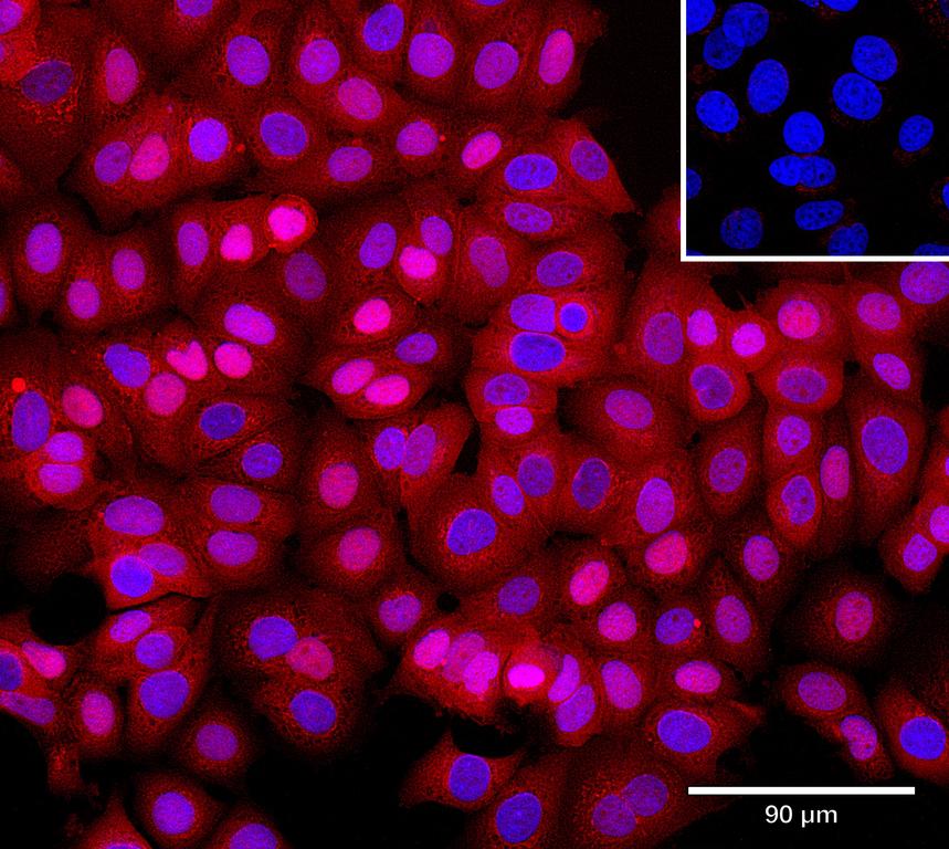 Ankyron CCN1_HUMAN Clone CO40476