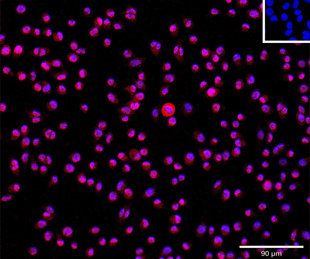 Ankyron CCN2_MOUSE Clone CO40542