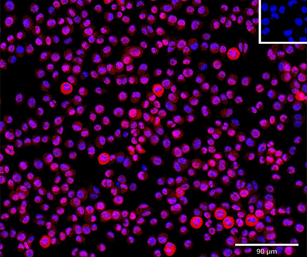 Ankyron CCN2_MOUSE Clone CO40537