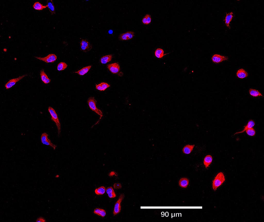 Ankyron CD14_HUMAN Clone AB40374