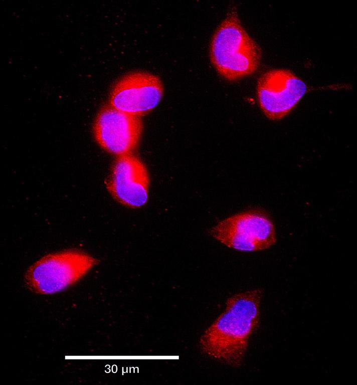 Ankyron CD14_HUMAN Clone AB40379