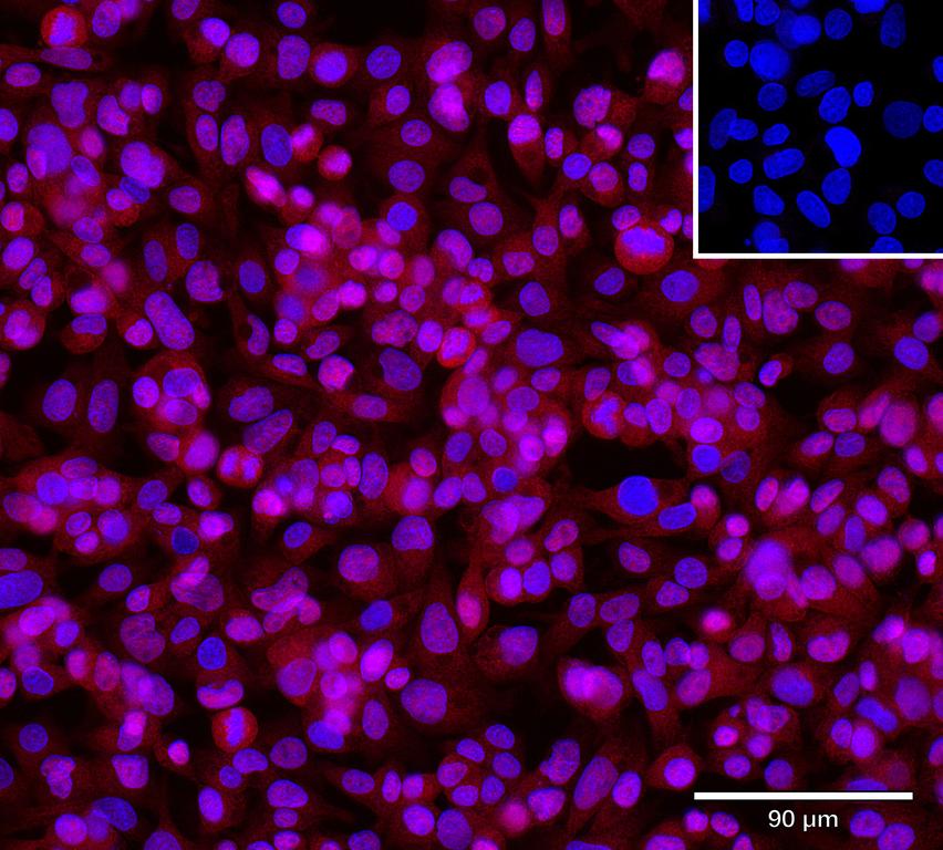 Ankyron CD177_HUMAN Clone CT30223