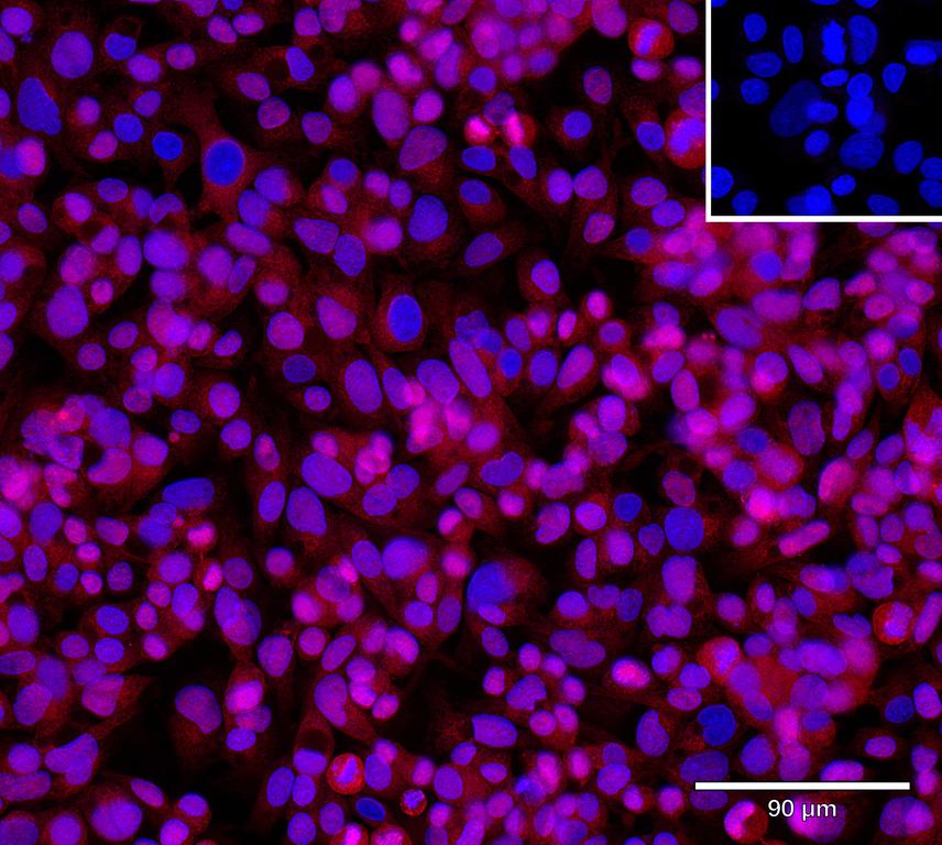 Ankyron CD177_HUMAN Clone DV40325