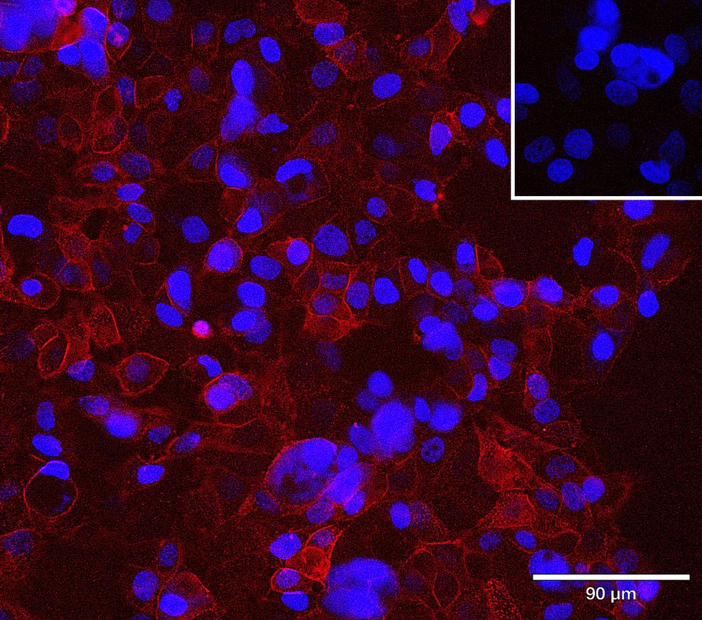 Ankyron CD276_HUMAN Clone CB30581
