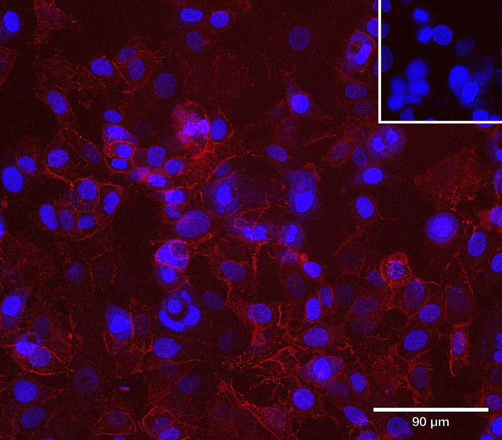 Ankyron CD276_HUMAN Clone CB30587