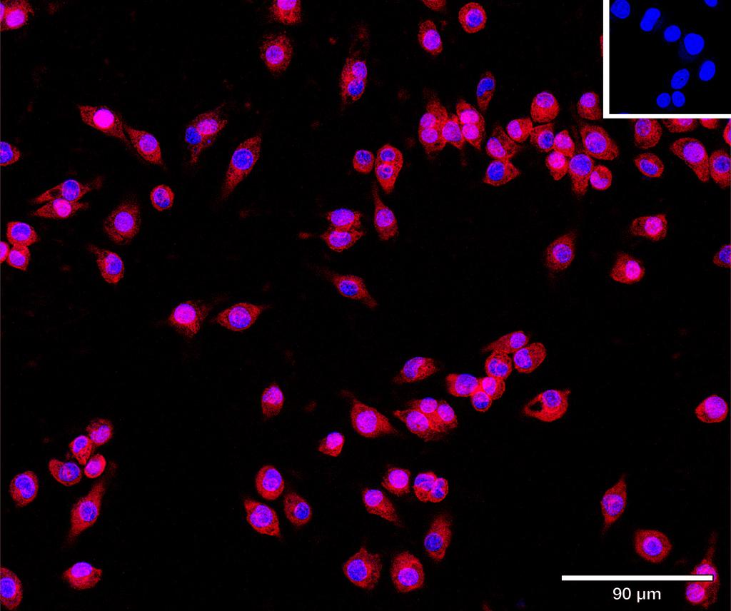 Ankyron CD276_MOUSE Clone CV40816