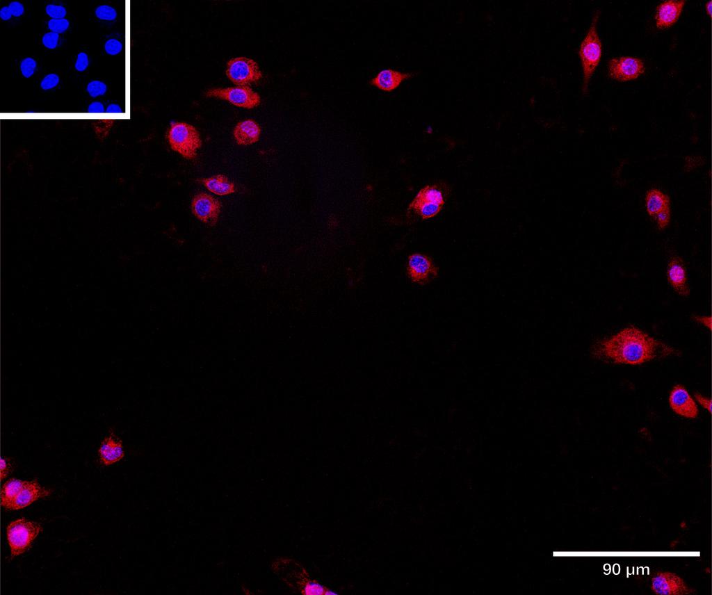 Ankyron CD276_MOUSE Clone CV40819