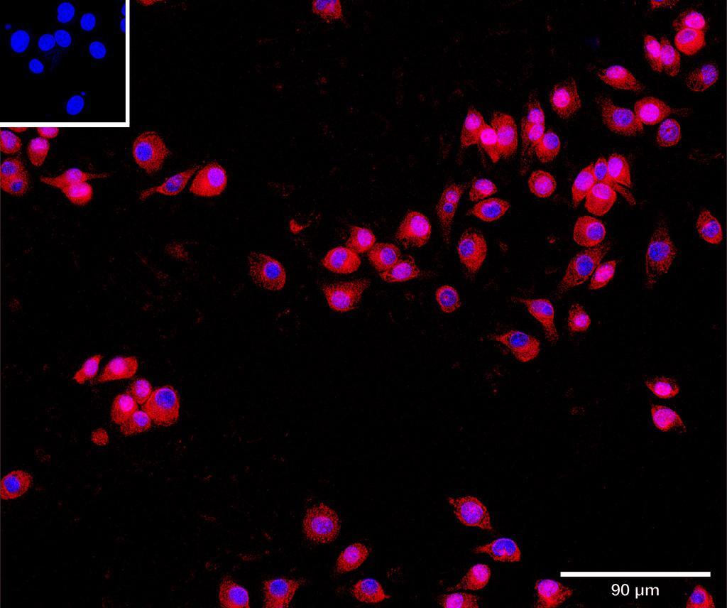 Ankyron CD276_MOUSE Clone CV40821