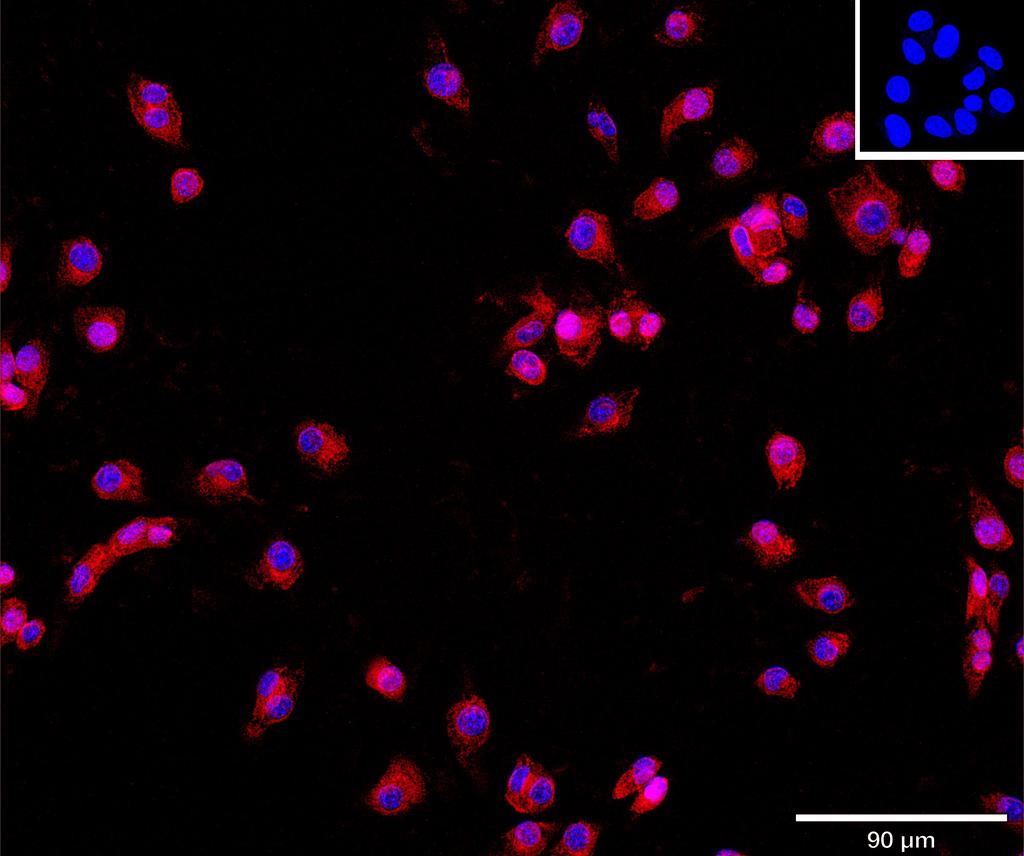 Ankyron CD276_MOUSE Clone CV40822