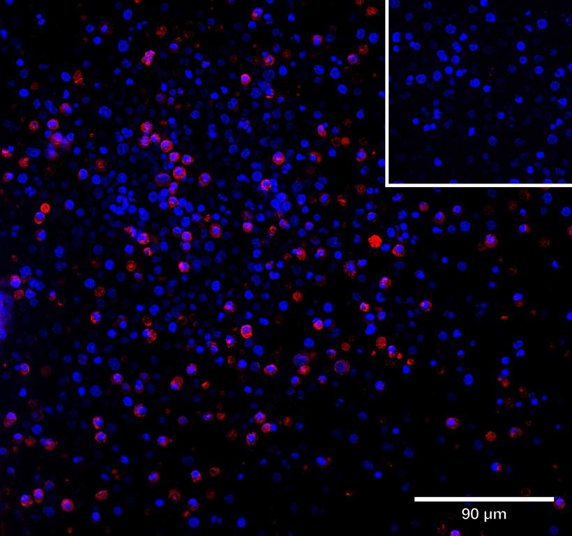 Ankyron CD27_HUMAN Clone AD40102