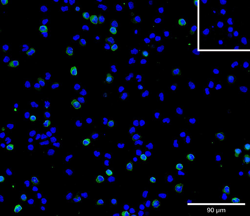 Ankyron CD28_HUMAN Clone AB40306