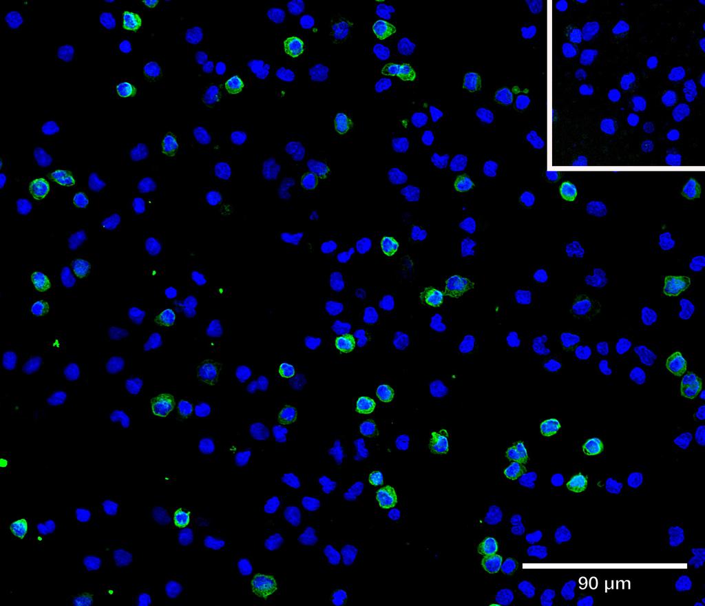 Ankyron CD28_HUMAN Clone AB40305