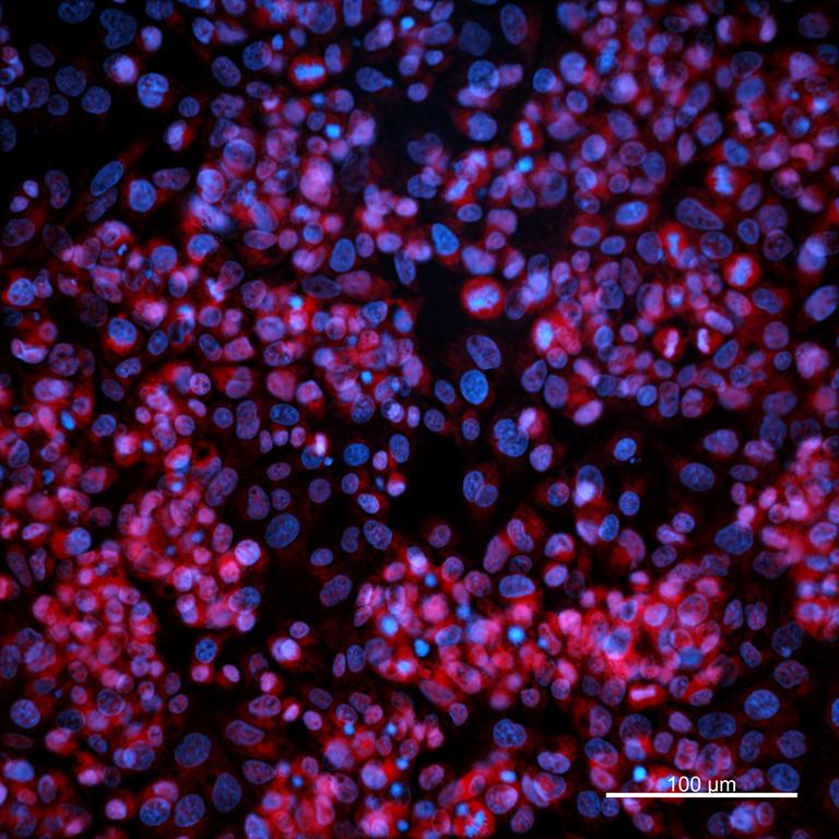Ankyron CD320_HUMAN Clone FV40453