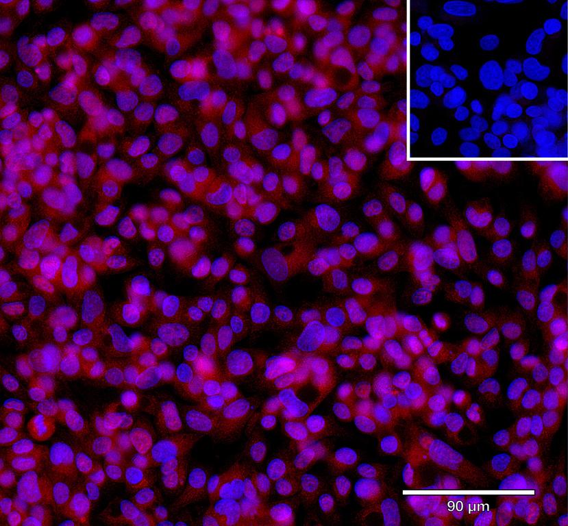 Ankyron CD320_HUMAN Clone FV40447