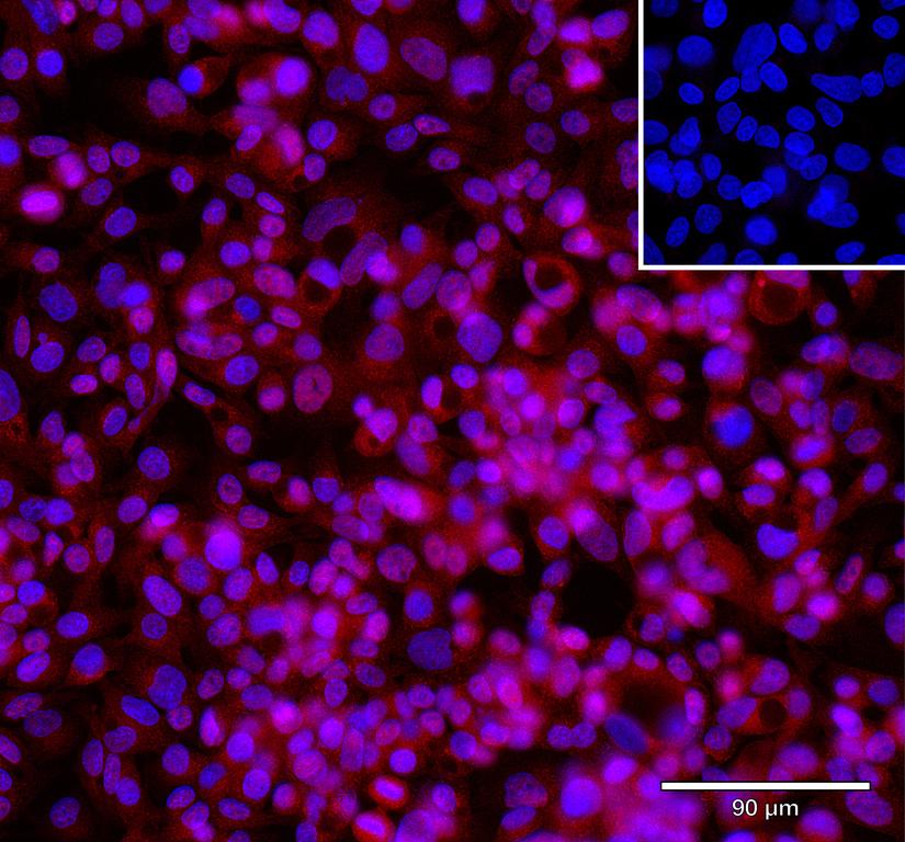 Ankyron CD320_HUMAN Clone FV40450
