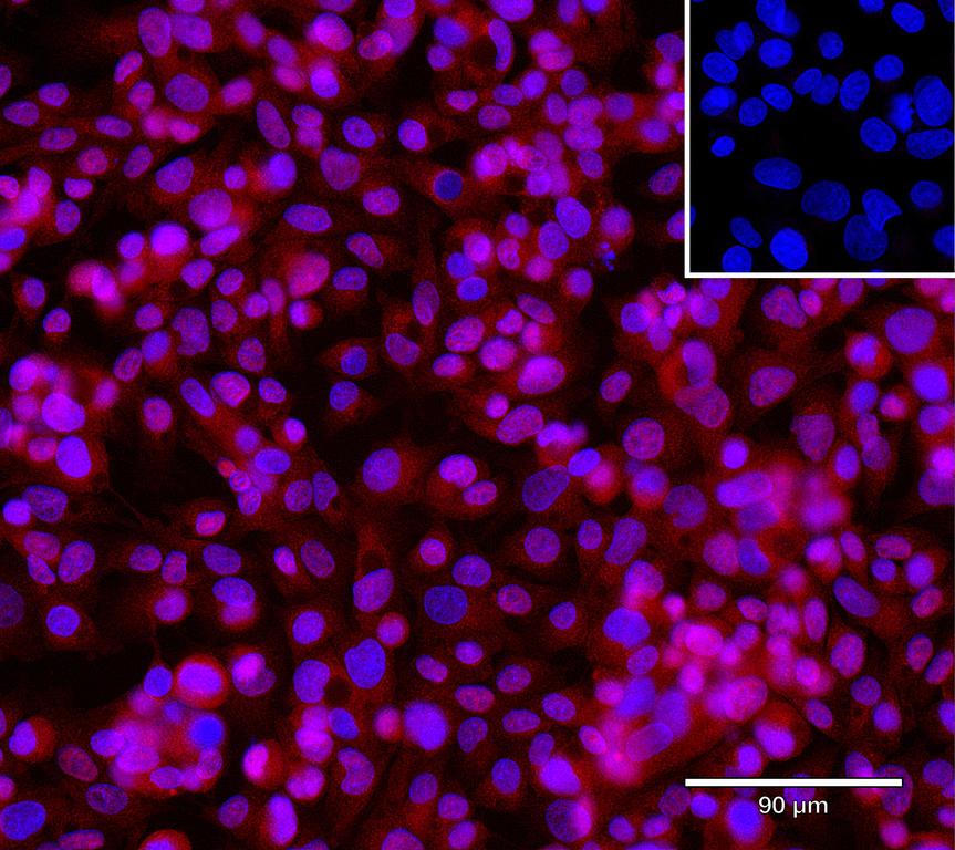 Ankyron CD320_HUMAN Clone FV40457