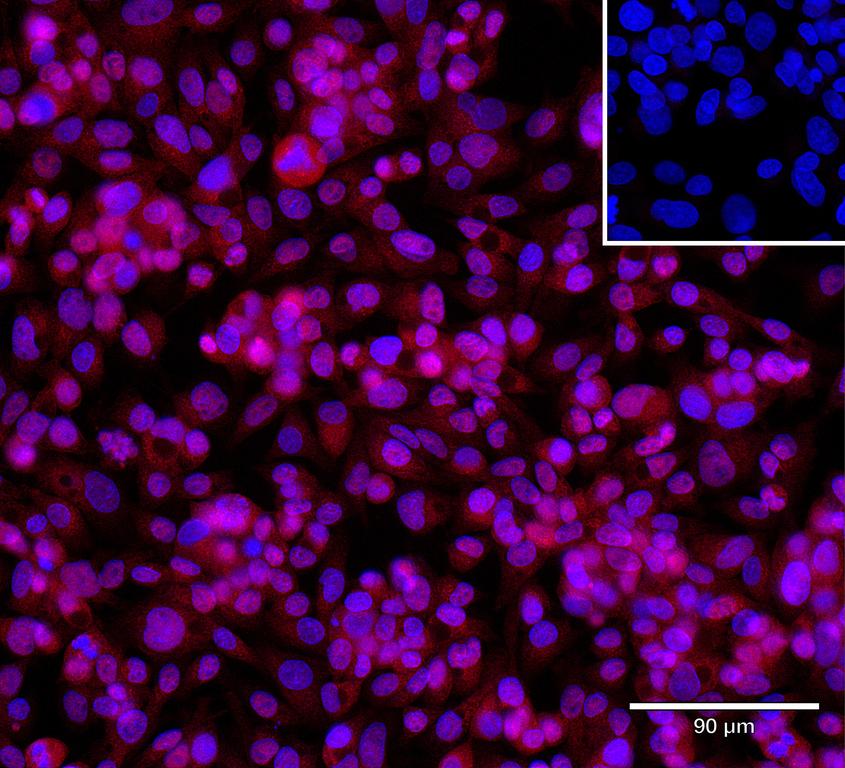 Ankyron CD320_HUMAN Clone FV40458