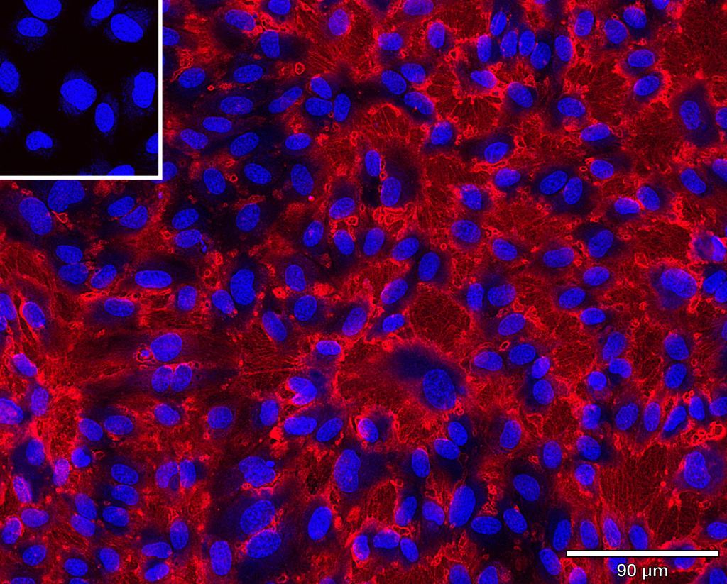 Ankyron CD34_HUMAN Clone AR40152