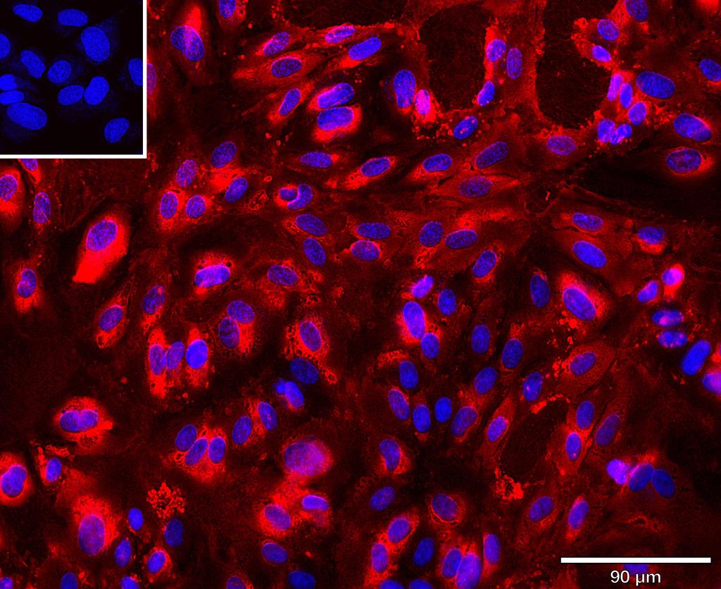 Ankyron CD34_HUMAN Clone AR40146
